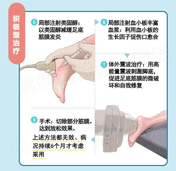 多图 | 足底筋膜炎的保守与微创治疗！症状、病因和复健全图解。