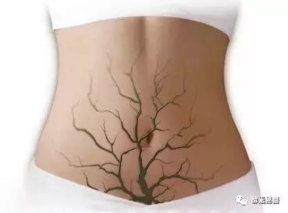 酵素清除体内垃圾与人体恢复健康！