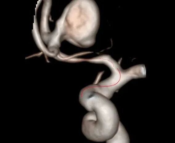 不会导管导丝基本操作?