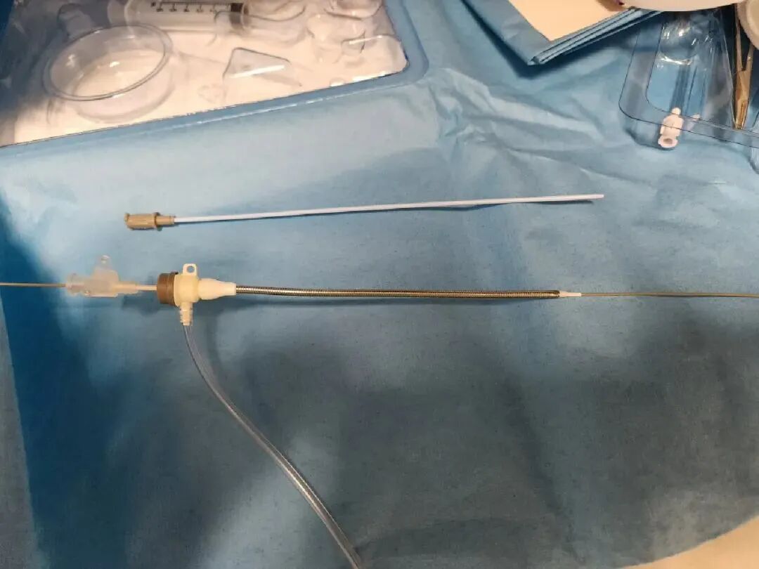 fr导管单位怎么读导管直径“French”的历史及含义_https://www.jmylbn.com_新闻资讯_第6张