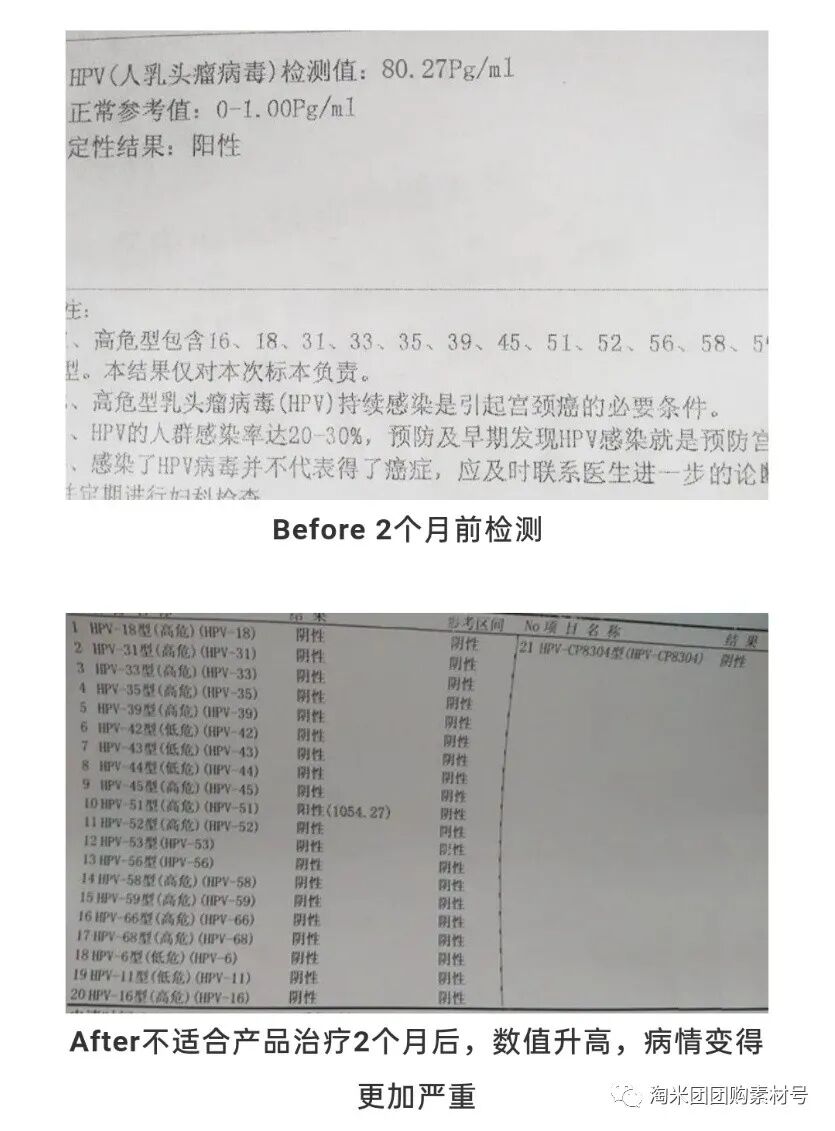 妇科蛋白膜怎么用【医师推荐】国药集团抗HPV生物蛋白妇科凝胶 ｜ 阻断HPV感染，恢复私处年轻态_https://www.jmylbn.com_新闻资讯_第56张