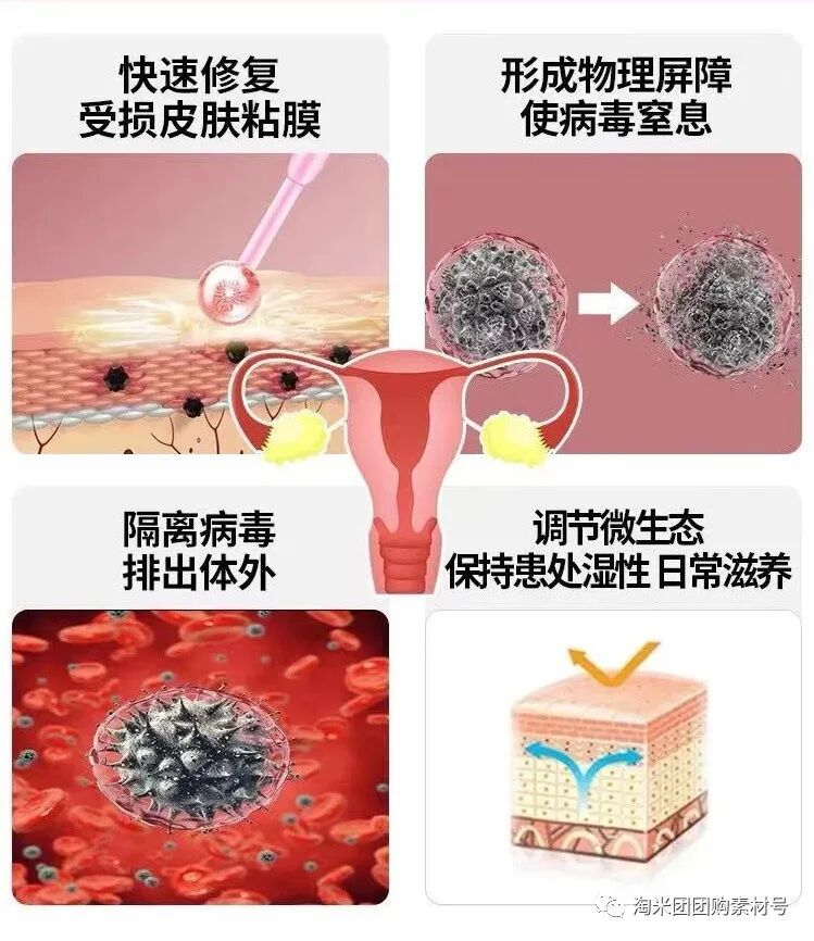 妇科蛋白膜怎么用【医师推荐】国药集团抗HPV生物蛋白妇科凝胶 ｜ 阻断HPV感染，恢复私处年轻态_https://www.jmylbn.com_新闻资讯_第34张