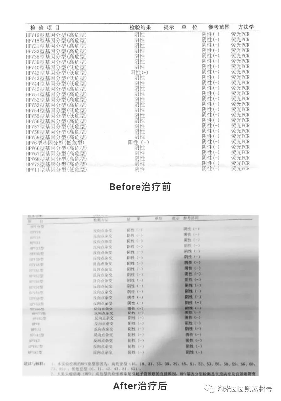 妇科蛋白膜怎么用【医师推荐】国药集团抗HPV生物蛋白妇科凝胶 ｜ 阻断HPV感染，恢复私处年轻态_https://www.jmylbn.com_新闻资讯_第46张