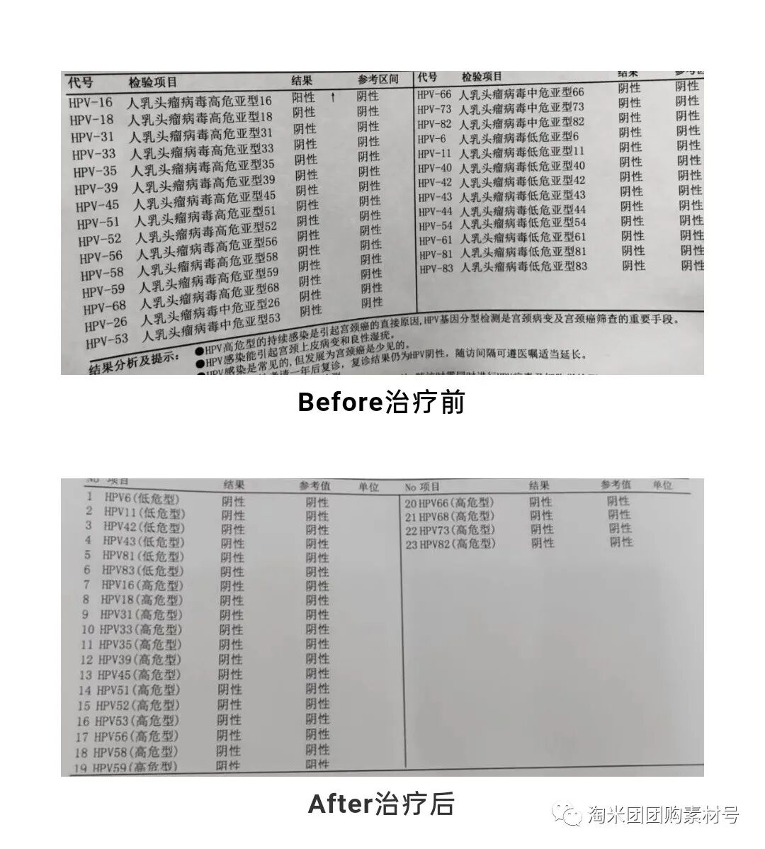 妇科蛋白膜怎么用【医师推荐】国药集团抗HPV生物蛋白妇科凝胶 ｜ 阻断HPV感染，恢复私处年轻态_https://www.jmylbn.com_新闻资讯_第44张