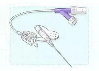 为什么输血不能用小针与留置针“和平共处”_https://www.jmylbn.com_新闻资讯_第13张