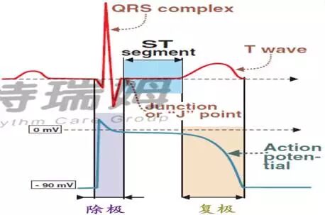 心电图怎么切换导联原来读懂心电图可以如此简单！_https://www.jmylbn.com_新闻资讯_第31张
