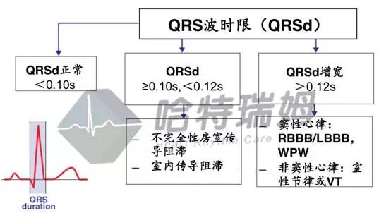 心电图怎么切换导联原来读懂心电图可以如此简单！_https://www.jmylbn.com_新闻资讯_第23张