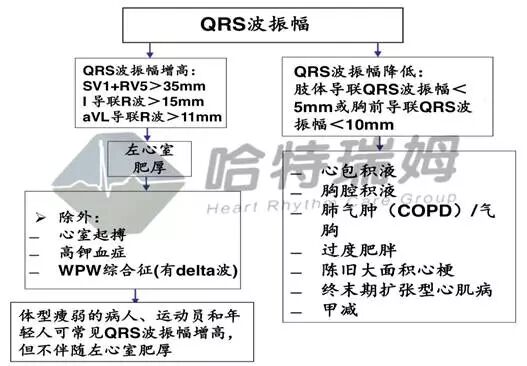 心电图怎么切换导联原来读懂心电图可以如此简单！_https://www.jmylbn.com_新闻资讯_第24张