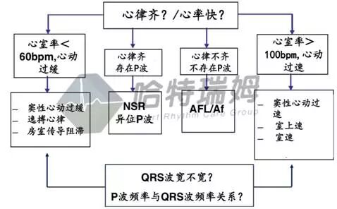 心电图怎么切换导联原来读懂心电图可以如此简单！_https://www.jmylbn.com_新闻资讯_第14张