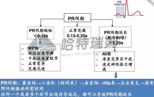 心电图怎么切换导联原来读懂心电图可以如此简单！_https://www.jmylbn.com_新闻资讯_第21张
