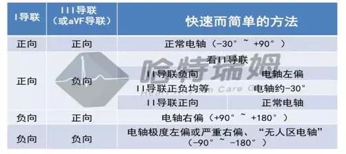 心电图怎么切换导联原来读懂心电图可以如此简单！_https://www.jmylbn.com_新闻资讯_第16张