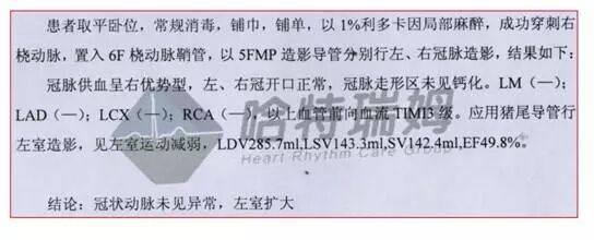 心电图怎么切换导联原来读懂心电图可以如此简单！_https://www.jmylbn.com_新闻资讯_第11张