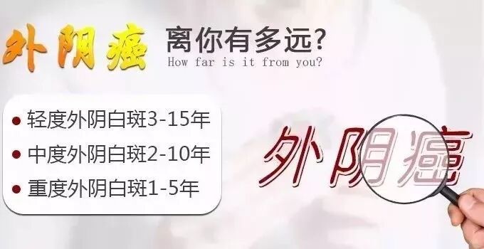 女性外阴白斑会癌变吗 外阴白斑认识 微信公众号文章阅读 Wemp