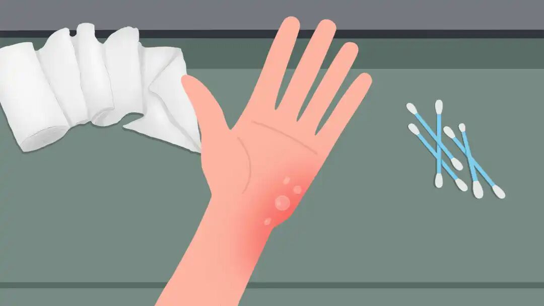 4006B光疗怎么用使用家用光疗仪真的能治好白斑吗？_https://www.jmylbn.com_新闻资讯_第5张