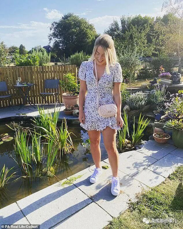 患严重脱发症的英国妹子，决定丢掉假发光头上街，结果……