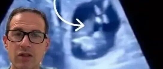 她姨妈连续14天不停，去看医生才发现，自己肝里居然怀了个娃？！