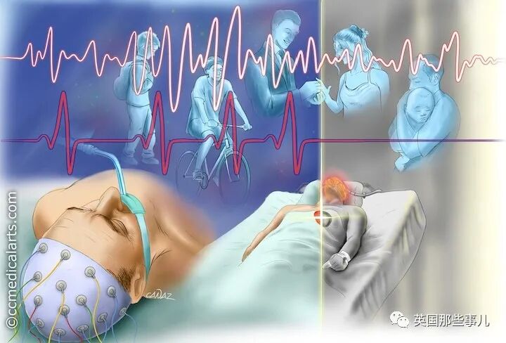临死前看到”人生走马灯”可能真存在?!科学家观测濒死脑电波，都和回忆有关！