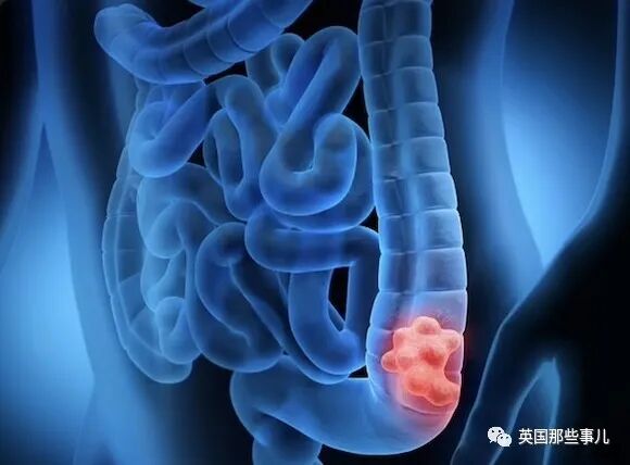 ����MSK����¡������ҩ�����������100����ֱ����ϸ��