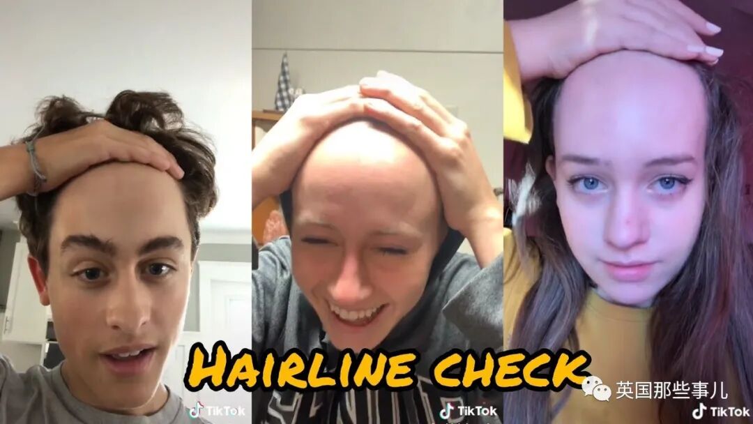 嫌额头太大，这妹子切掉头皮缩额头！发际线直接拉低3厘米，这都行？？