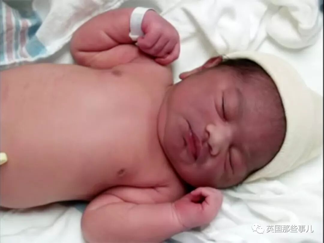 Колики у ребенка новорожденного при грудном вскармливании. Запор у новорожденного. Цвет кала при различных заболеваниях. Генетическое заболевание галактоземия. Рвота у ребенка грудничка.