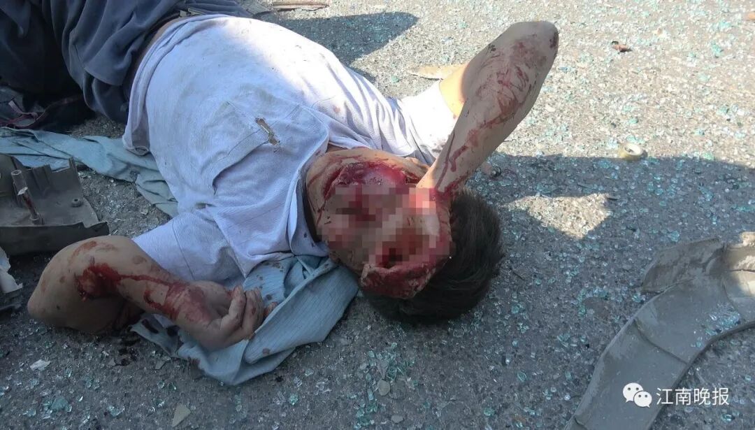 无锡一拉土车迎面撞上夏普公司大巴车 致多人受伤