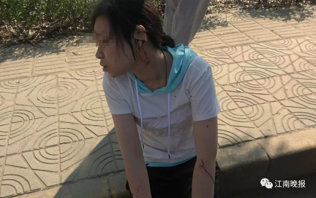 无锡一拉土车迎面撞上夏普公司大巴车 致多人受伤