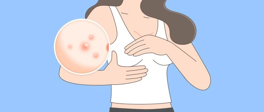 乳腺结节会变癌症吗？体检报告这项很关键！