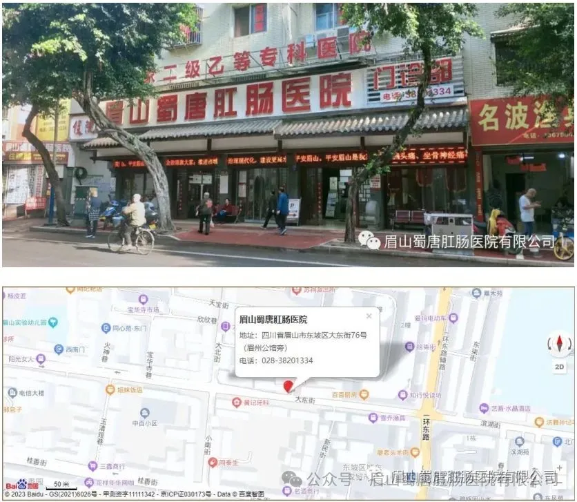 关于“痔疮”的十大谣言(图14) 图片