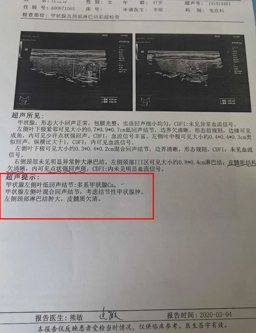 图片[4]-穿刺活检，进一步辨别良恶性因“冠状病毒肺炎”-首码网-网上创业赚钱首码项目发布推广平台