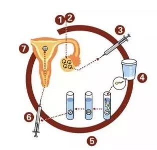 懷孕去美國(guó)生孩子_懷孕生美國(guó)孩子去哪里生_懷孕后去美國(guó)生孩子