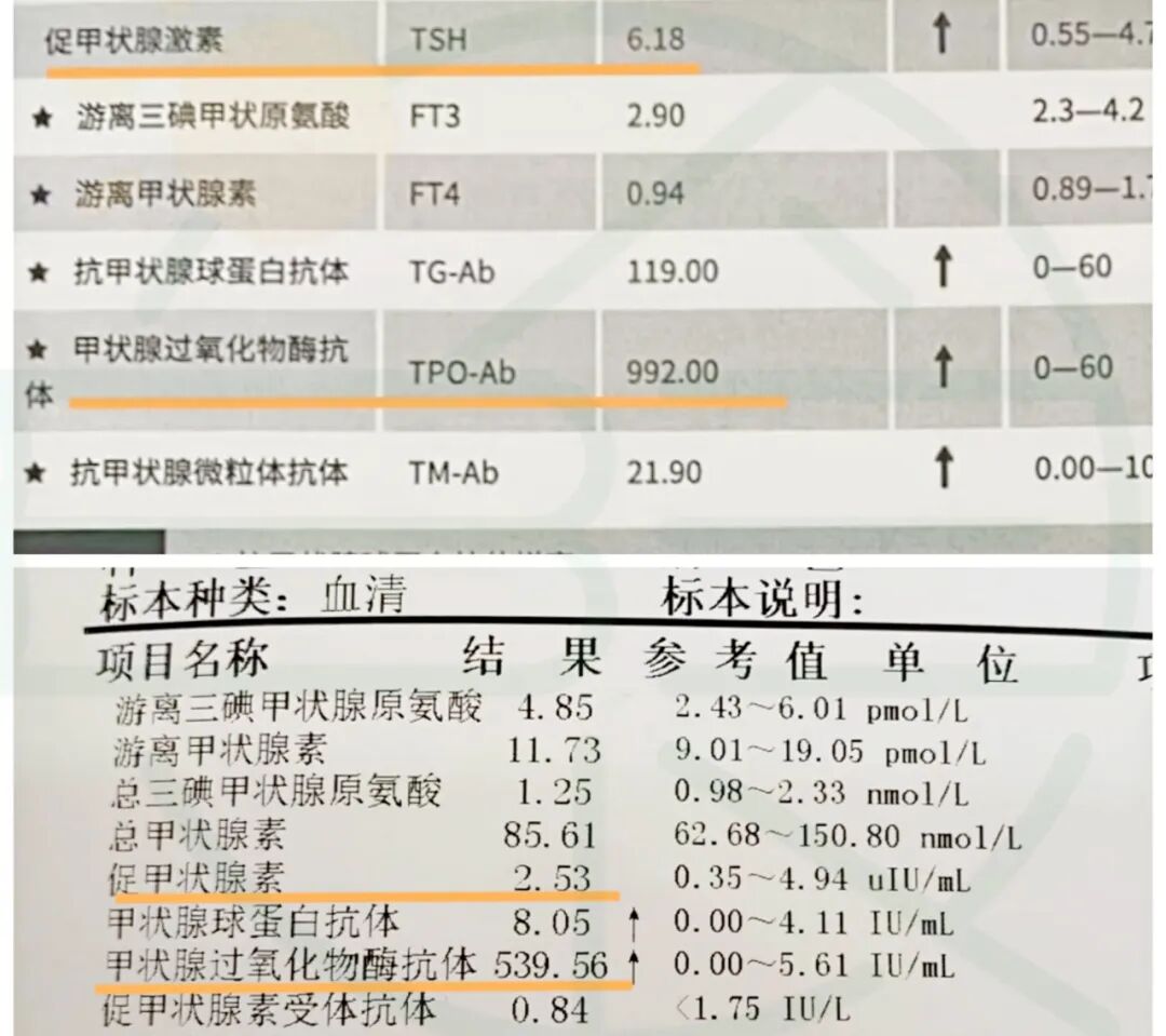 600多份体检报告研究之甲状腺结节、桥本、甲减、甲亢总结篇