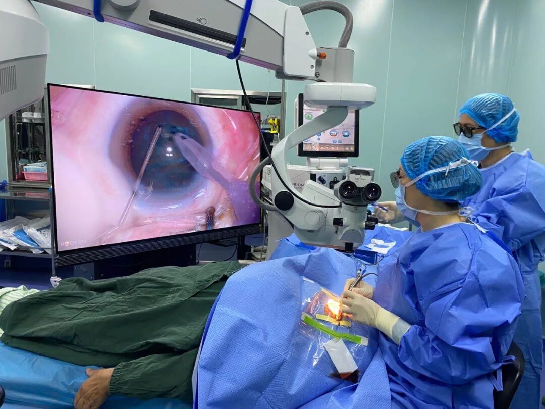 手术室上演3d大片明水眼科医院白内障手术进入3d可视化时代