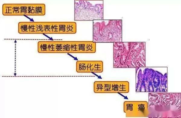 恶性血虚
看什么科好呢女（恶性血虚
血通例
能查抄
出来吗）《恶性血液病能治好吗》