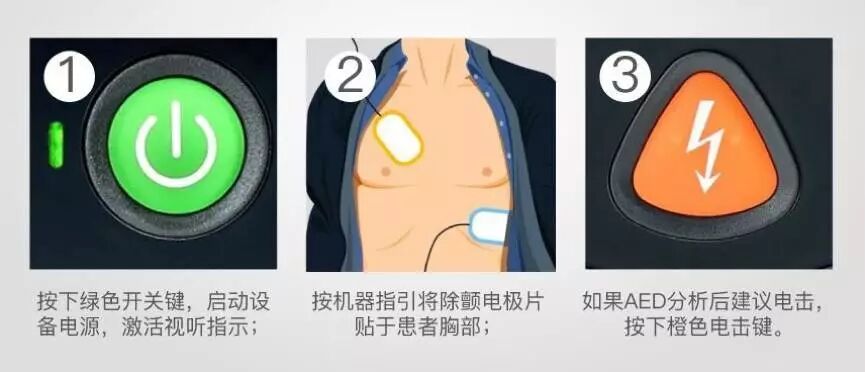 什么是aed除颤AED介绍及除颤原理_https://www.jmylbn.com_新闻资讯_第18张
