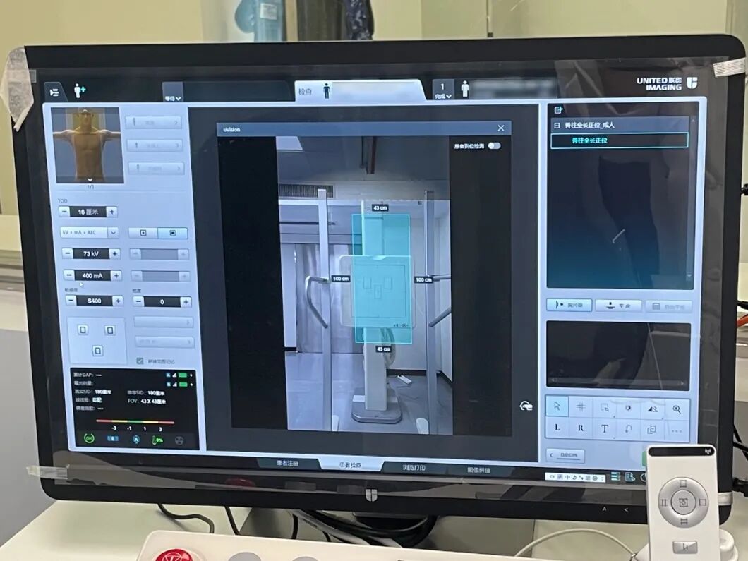 dr设备是什么【五期工程设备展示：联影uDR】联影智能DR在邵逸夫医院新大楼正式启用_https://www.jmylbn.com_新闻资讯_第4张