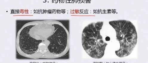 cover_image