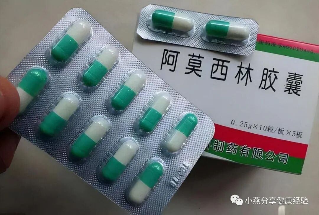 阿莫西林是消炎药吗？提醒：真正的消炎药只有2种，别吃错