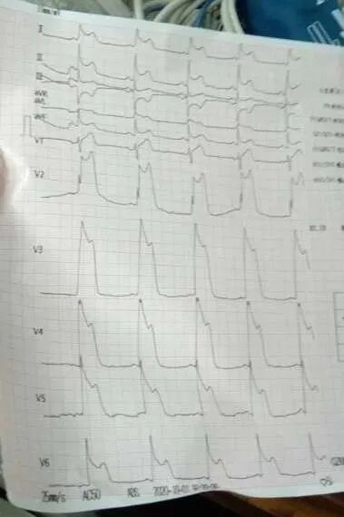 “国庆中秋双节同庆，我捡回了一条命……”