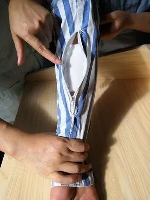 picc导管是什么材质关于“PICC”那些事_https://www.jmylbn.com_新闻资讯_第12张