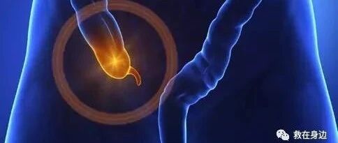 急性阑尾炎有哪些表现？