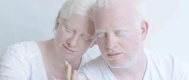 白化病——你了解吗？