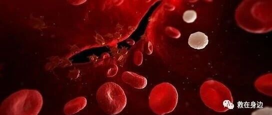 急性出血性凝血功能障碍诊治专家共识