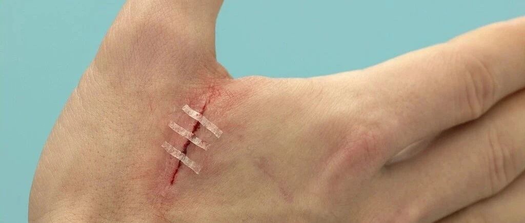 关于急诊清创缝合有关内容汇总