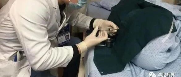 【浙大二院】辗转就医十几年才确诊，这种罕见病误诊率很高