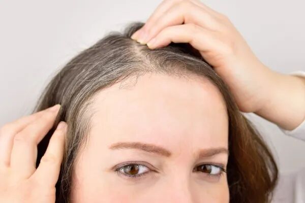 女人掉头发是什么病？是身体出现这6个问题了