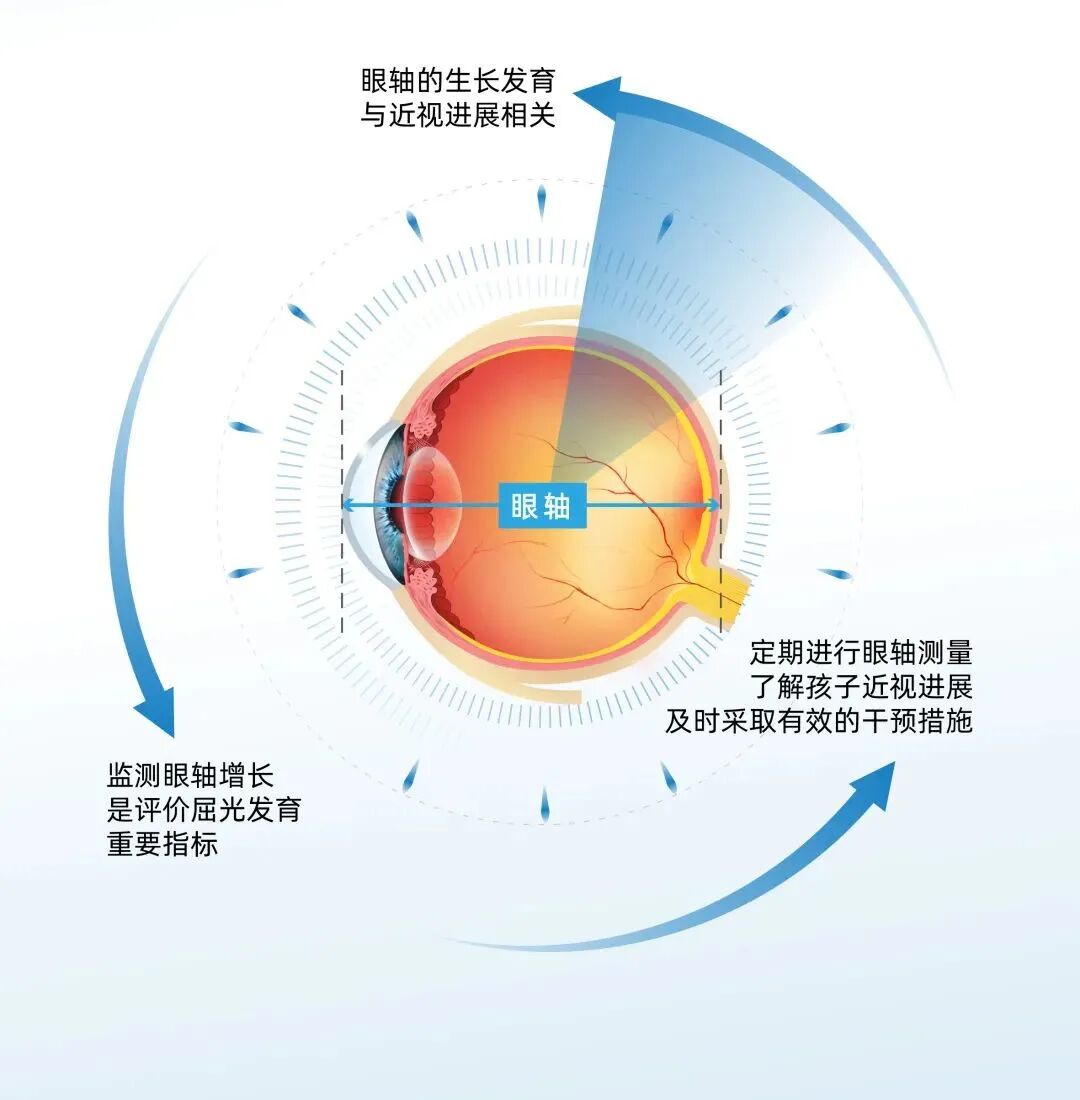 眼科生物测量仪怎么看认识眼轴生物测量仪，科学精准配镜！_https://www.jmylbn.com_新闻资讯_第3张