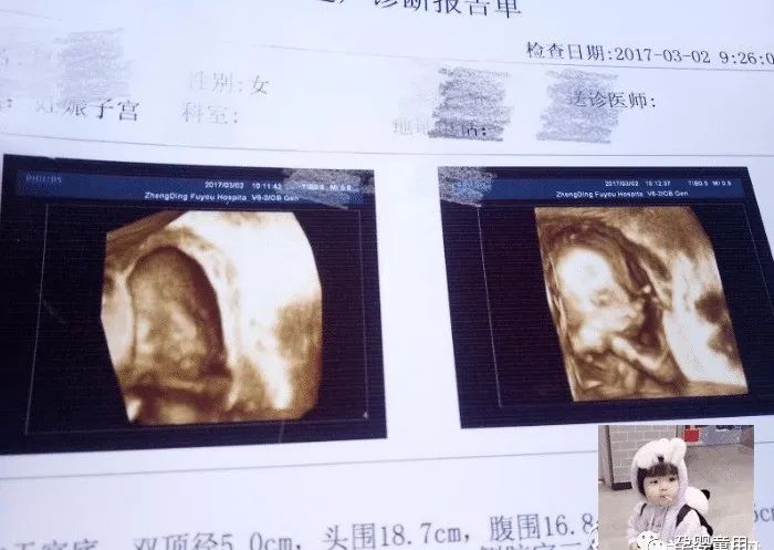 为什么说男翻女几率大_4个的原因男翻女_男翻女可能性