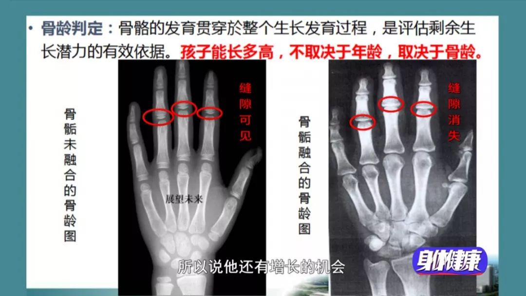 想讓孩子多長高10公分？這兩個長個關鍵期，錯過後悔！ 親子 第5張