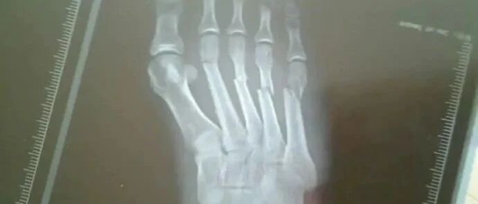 “买了性感袜想给老公惊喜！结果…惊喜变成惊吓！”