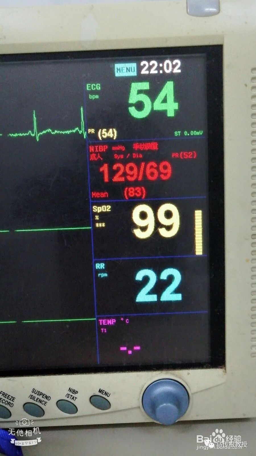 监护仪参数怎么看科普：如何看监护仪上的参数_https://www.jmylbn.com_新闻资讯_第2张